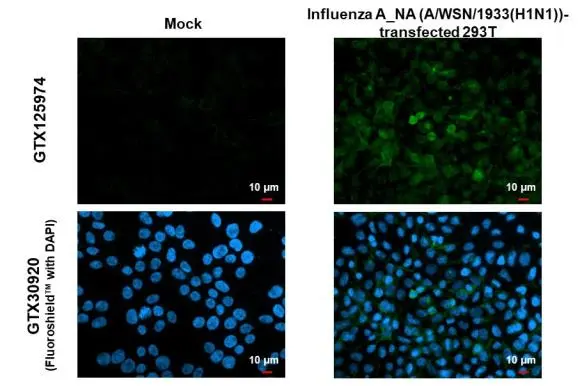 Rabbit Polyclonal Anti-FAM13A Antibody - Buy for research